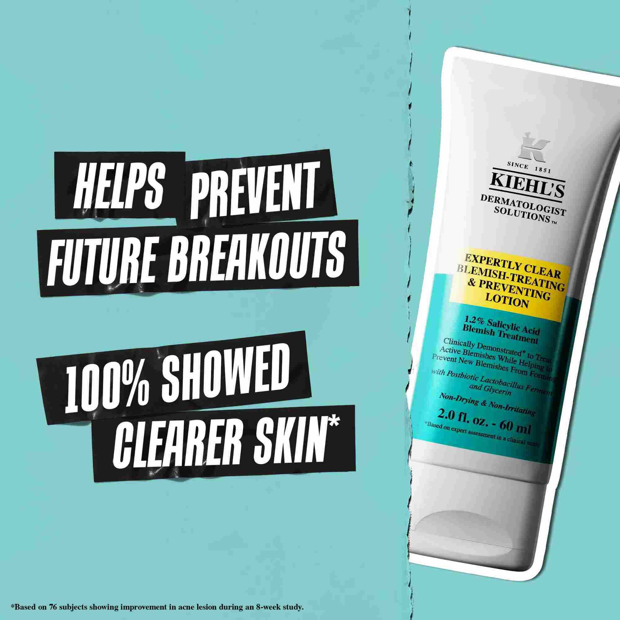 Tuba Expertly Clear Blemish-Treating & Preventing Lotion na plavoj pozadini sa tekstom: „Pomaže u sprečavanju budućih bubuljica” i „100% je pokazalo čistiju kožu.”