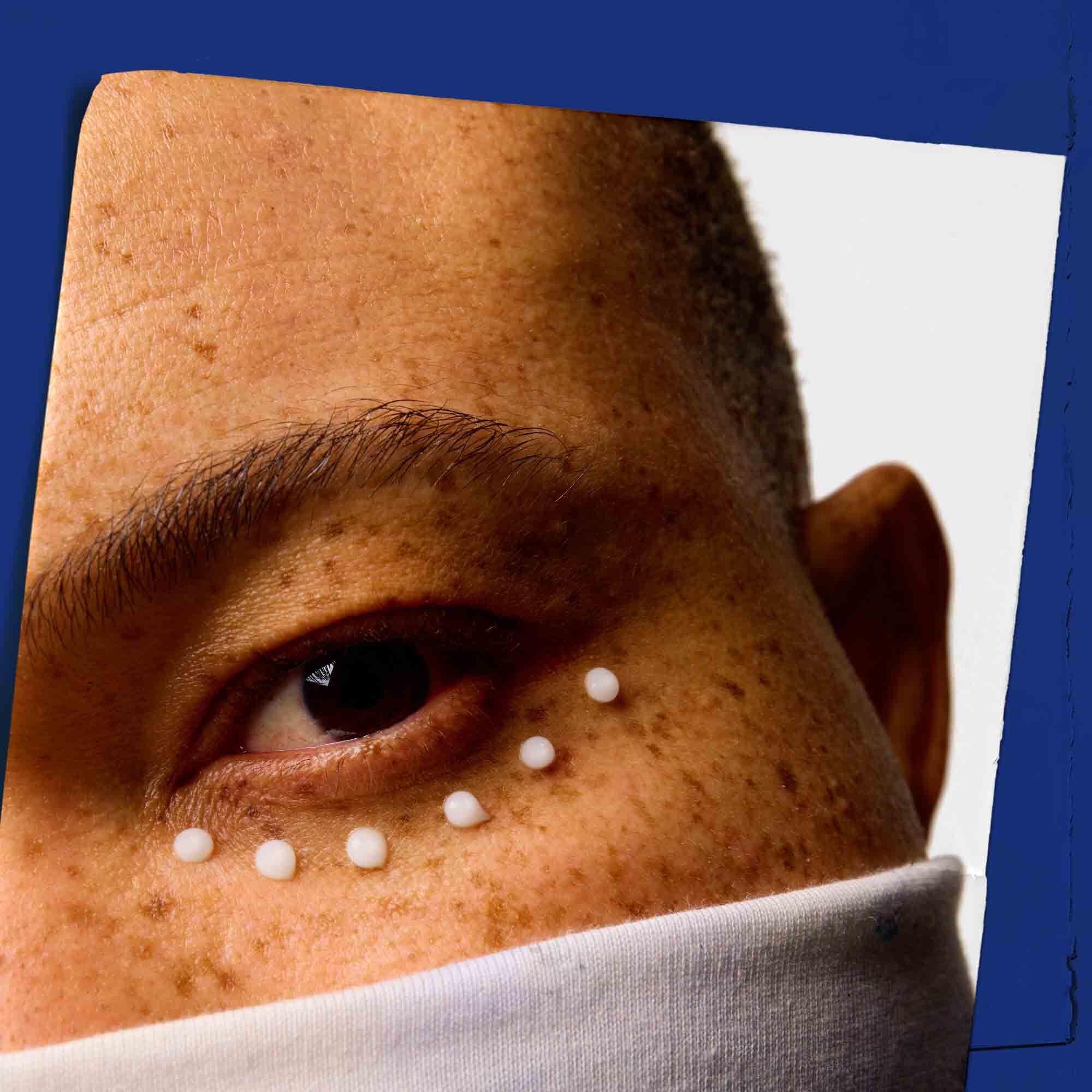 Krupni plan kože oko očiju sa tačkicama Facial Fuel Eye Fuel.