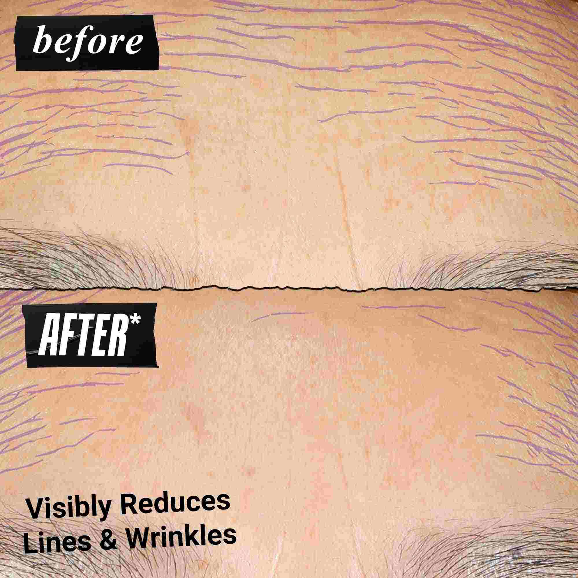 Fotografija Pre i Posle – Kiehl's Retinol Skin Renewing Daily Microdose pomaže u poboljšanju tona i teksture kože