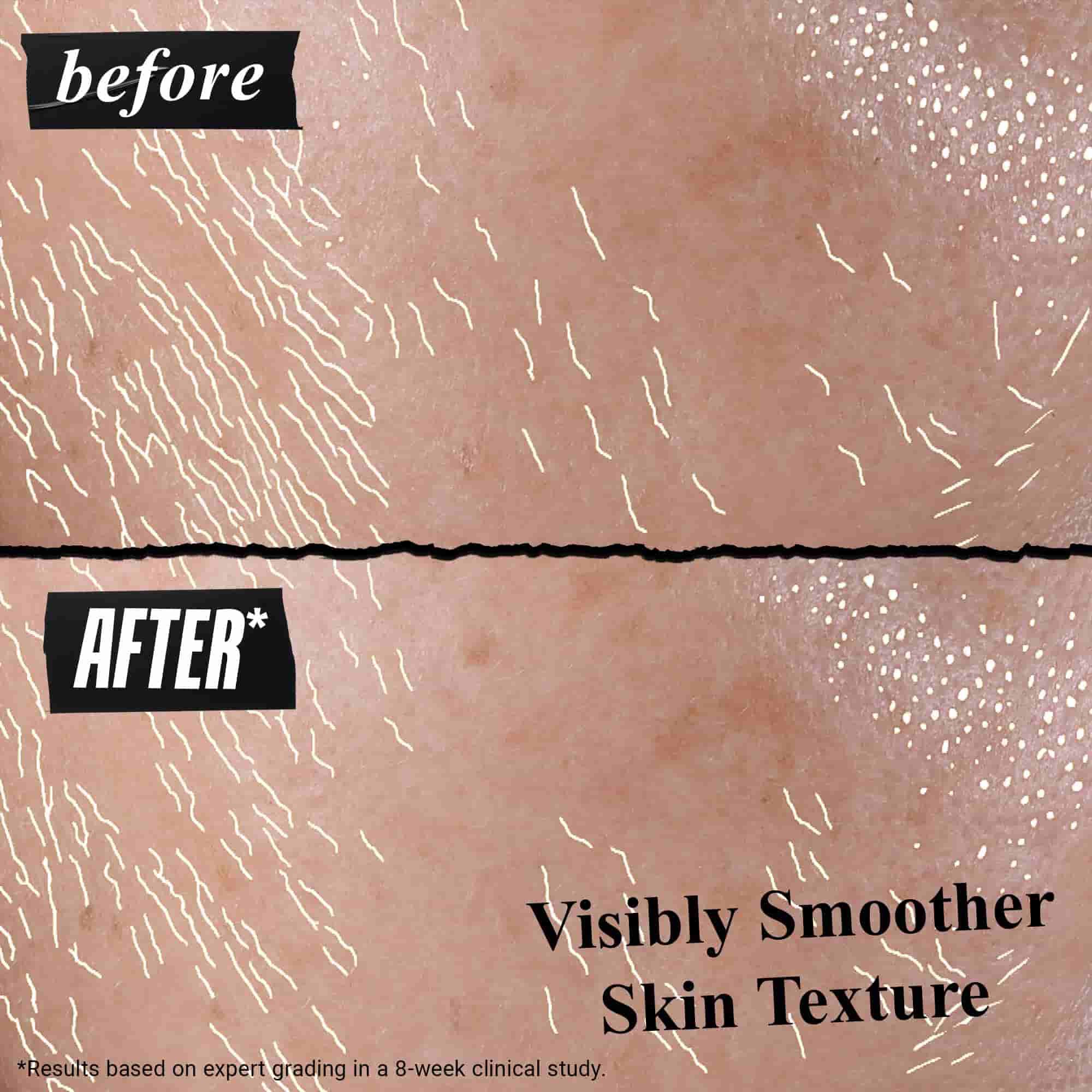 Rezultati na koži pre i posle Better Screen UV Serum