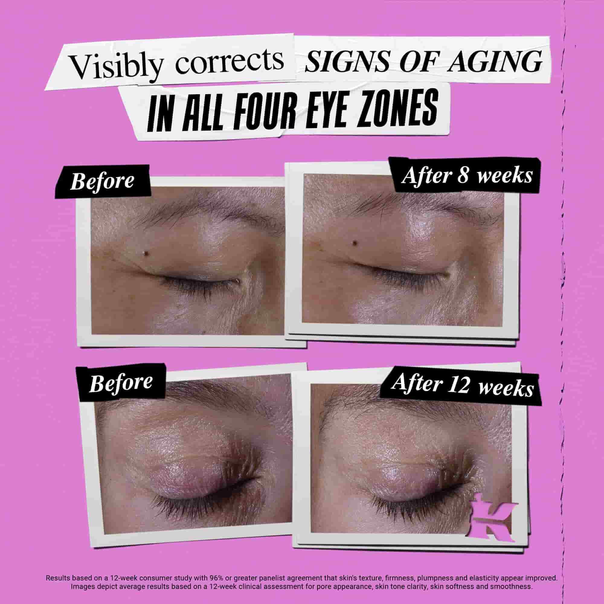 Fotografija Pre i Posle – Kiehl's Super Multi-Corrective Eye Zone Treatment korigira znakove starenja
