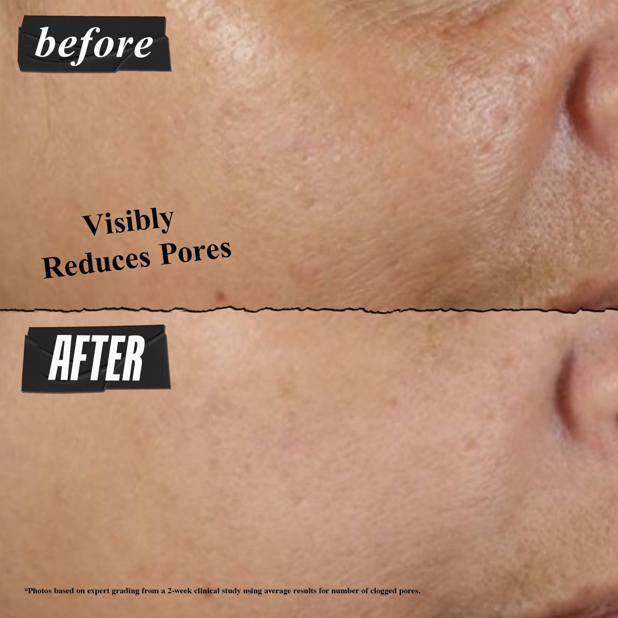 Maska za dubinsko čišćenje pora od retke zemlje