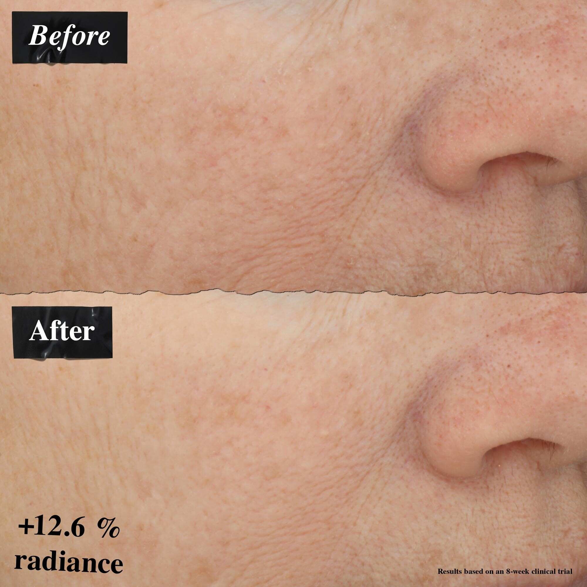 Poređenje slika pre i posle koje pokazuje poboljšanje crvenila kože nakon upotrebe Powerful-Strength Line-Reducing Concentrate.