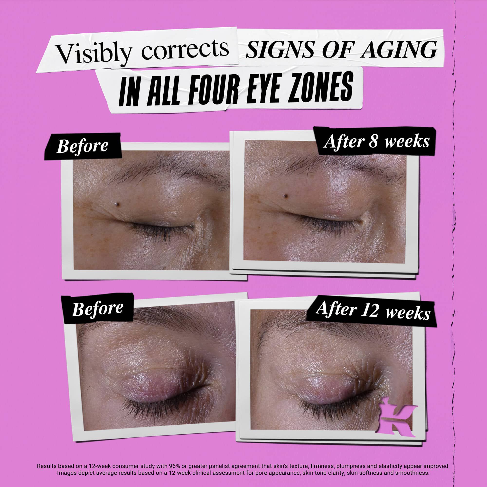 Fotografija Pre i Posle – Kiehl's Super Multi-Corrective Eye Zone Treatment korigira znakove starenja