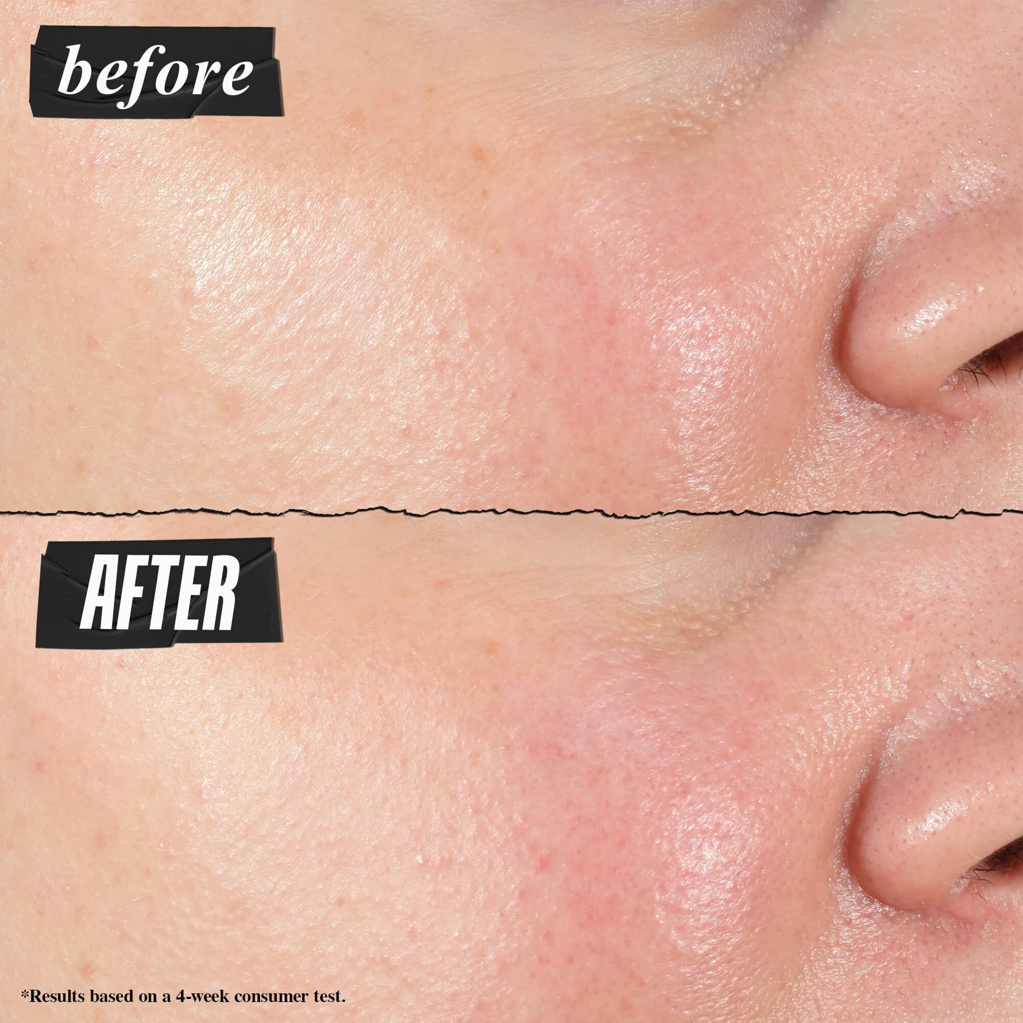 Fotografija Pre i Posle – Kiehl's Hydro Plumping Serum Concentrate vidljivo smanjuje pore