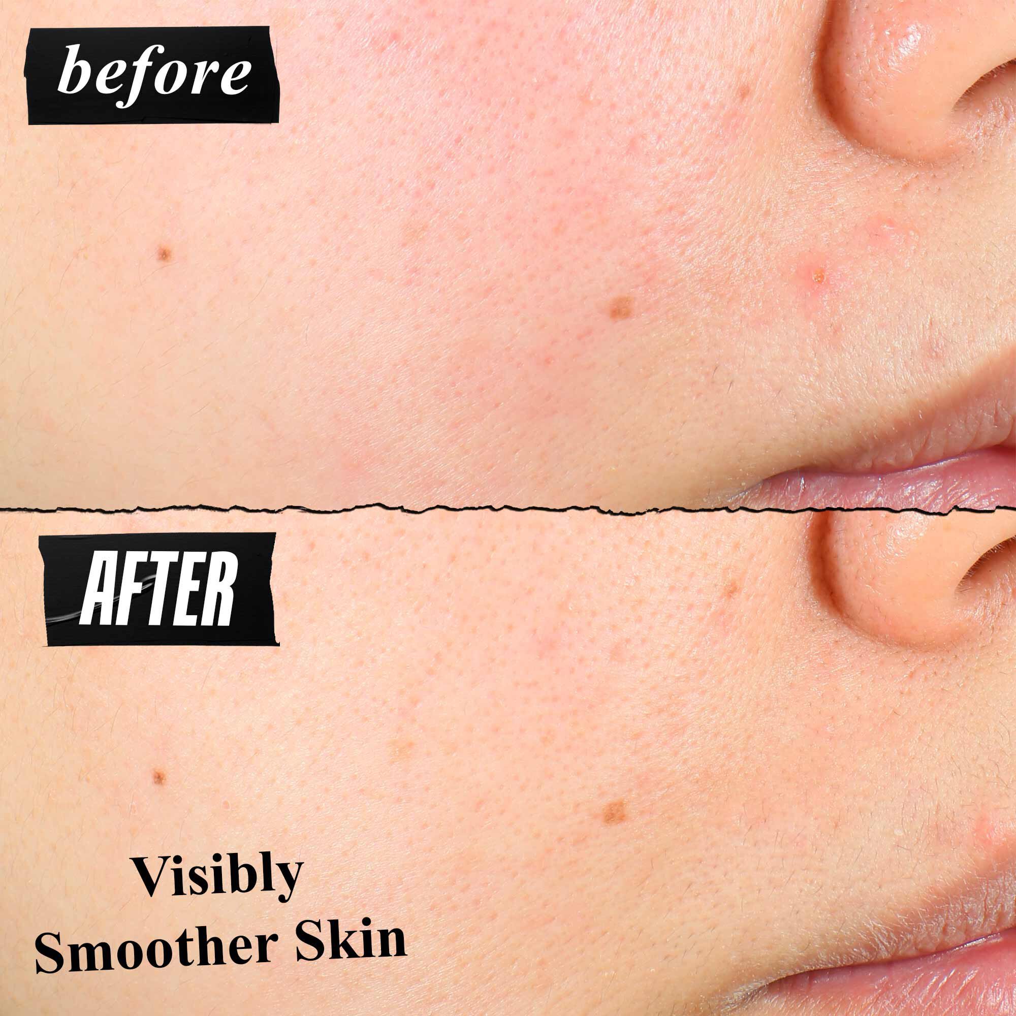 Poređenje teksture kože pre i posle koje pokazuje vidno glađu kožu nakon upotrebe.
