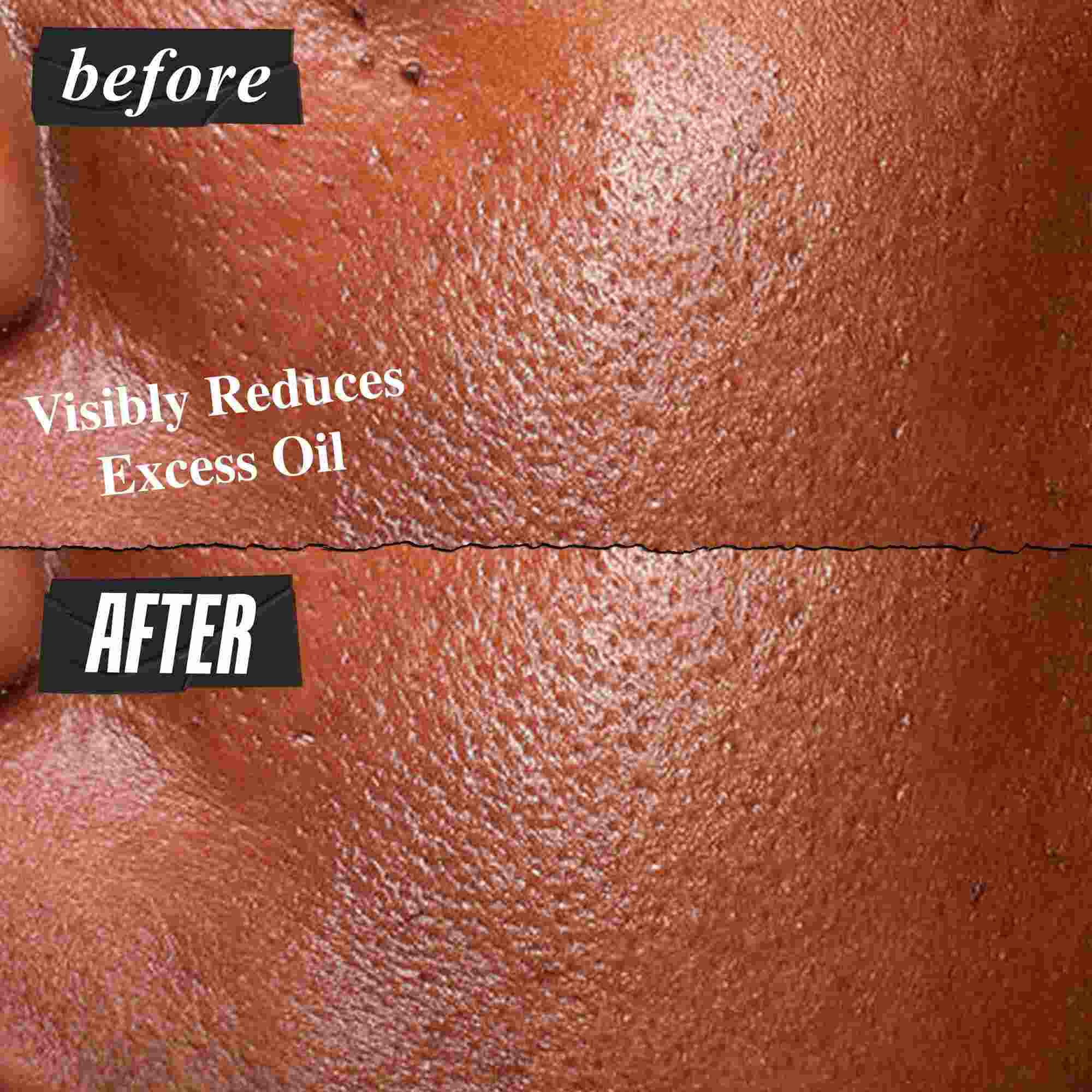Fotografija Pre i Posle – Kiehl's Ultra Pure serum vidljivo smanjuje višak masnoće