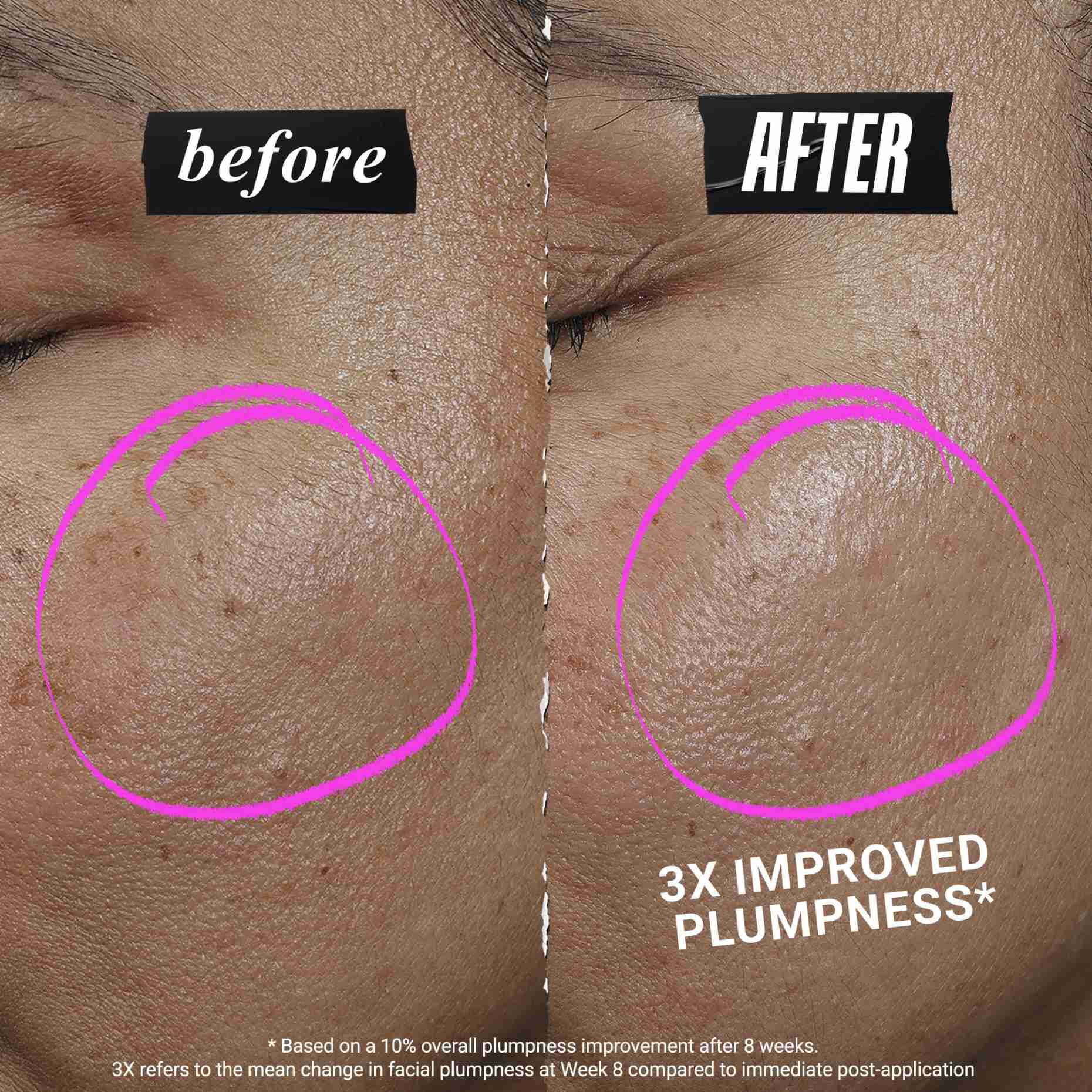 1cc CollaShot Plump serum, serum za lice sa rekombinantnim kolagenom za čvršći i puniji izgled kože