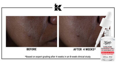 Before and after comparison of skin texture, showing improvement after four weeks of using Kiehl's Ultra Pure Glycolic Acid serum, with a dropper bottle of the serum featured in the image.